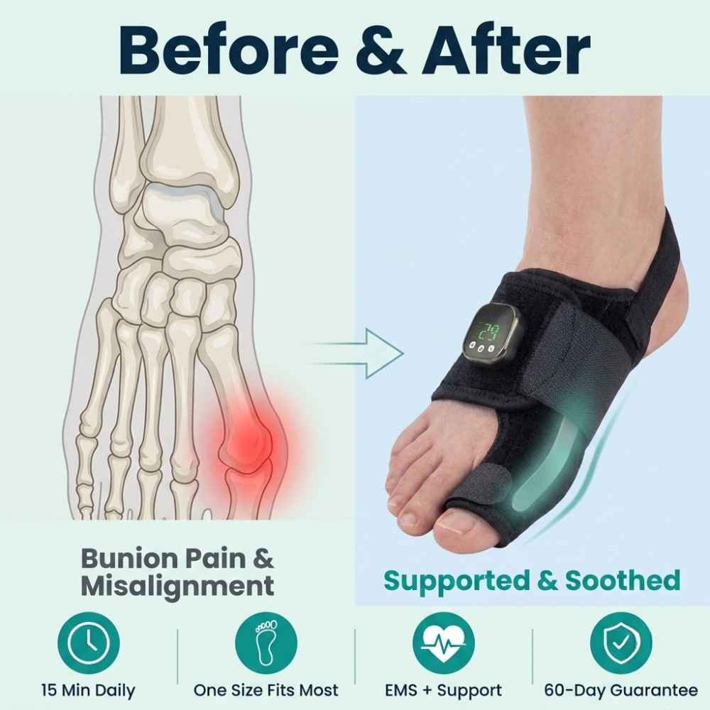 VELNORA™ | EMS Bunion Corrector