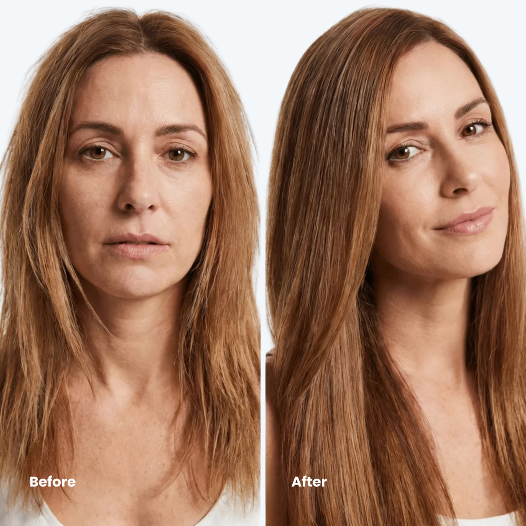 SÉLORA™ | Scalp Oil